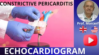 How to Escape the Grip of Constrictive Pericarditis Echocardiography Diagnose [upl. by Ecertap945]