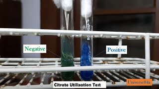 Citrate Utilization Test Positive and Negative Demonstration [upl. by Saimon352]