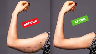 Burn Flabby ARMS FAT 10 Minute Arm Flab Workout  No Equipment Needed [upl. by Aver]