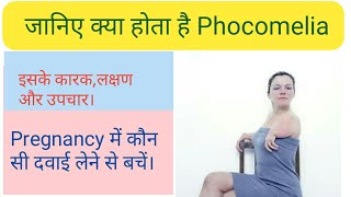 What is Phocomelia its cause and treatment [upl. by Sucrad]