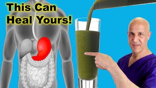 This Juice Healed My STOMACH amp GUTIt Can Heal Yours Dr Mandell [upl. by Fidole414]