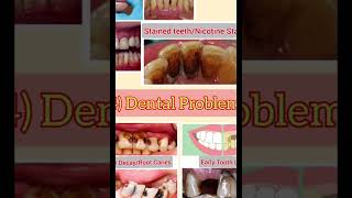 Effects of tobacco Smoking on teensteenageadultsLeo Dentistry [upl. by Dom]