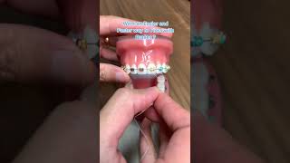 Easier Way to Floss with Braces  Platypus Floss [upl. by Jorin440]