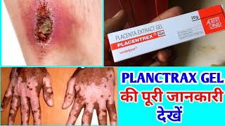 PLACENTREX GEL की पूरी जानकारी देखें फ़ायदे और नुकसान जानें  PLACENTREX GEL USES IN HINDI [upl. by Igiul922]