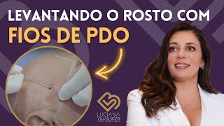 Veja a Colocação de FIOS DE SUSTENTAÇÃO PDO Harmonização Facial  Dra Luciana Villas Bôas [upl. by Merle]