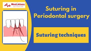 Suturing in Periodontal Surgery l Suturing techniques l Wound suturing l Mediklaas [upl. by Eilyak]