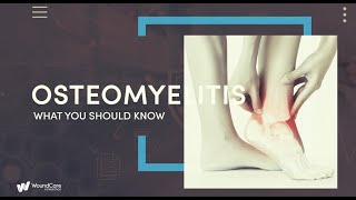 Osteomyelitis Facts  What You Should Know [upl. by Anul]