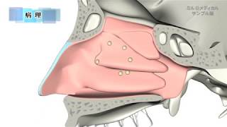 アレルギー性鼻炎／2分で分かる医療動画辞典 ミルメディカル [upl. by Betthezel]
