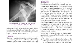 shoulder dislocations Elbow dislocations and Hip dislocations [upl. by Eula]