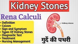 Kidney stones  Kidney stones symptoms Kidney stone treatment [upl. by Niehaus]