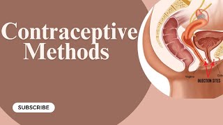 Contraceptive methods  Gynaecology Lecture  Part 11 [upl. by Dranyam]