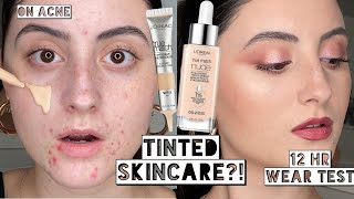 Best Makeup Day LOREAL TINTED HYALURONIC SERUM amp EYECREAM ON ACNE  10 Hour Wear Test [upl. by Nottarts]