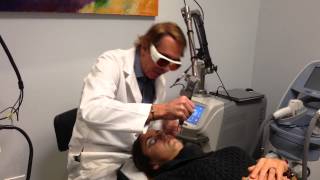 Spectra Carbon Laser Acne Peel Treats and Prevents Acne Dr Weiner Destin Florida [upl. by Shaff]