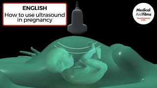 How to use ultrasound in pregnancy [upl. by Trina372]