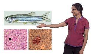 Lalita Ramakrishnan Cambridge 2 The Troublesome Tubercle in Tuberculosis [upl. by Hahsia]