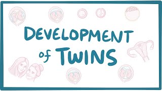 Development of twins [upl. by Annahsor]