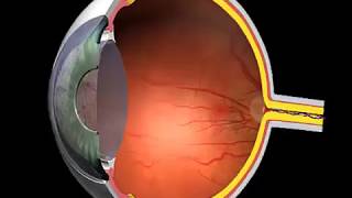 How Macular Degeneration is Caused Animation  Eye Health Videos [upl. by Zealand]