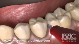 HOW TO USE AN INTERDENTAL BRUSH [upl. by Portie]