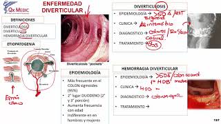 Diverticulitis [upl. by Lamori]