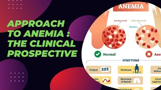 Approach to Anemia  The clinical Prospective [upl. by Eek]