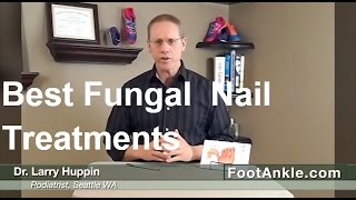 What are the Best Treatments for Fungal Toenails  Seattle Podiatrist Larry Huppin [upl. by Adnawot]