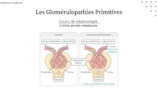 les Glomérulopathies Primitives  LGM HSF GEM maladie de BERGER GNMP GNRP nephro [upl. by Viens544]