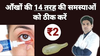 ₹2 मे आँखो को ठीक करे  Conjunctivitis  Pink eye  Chloramphenicol eyecaps [upl. by Cammy362]