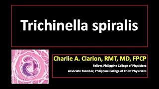 Trichinella spiralis [upl. by Atnauqahs]