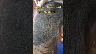 nits hair nitsremoval eeru haircare peenu ytshorts nits removal treatment hair problem [upl. by Aloysius]