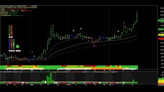 VPA 5 Features [upl. by Davison813]