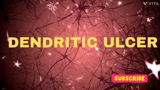 Dendritic ulcer  ULCER  OPHTHALMOLOGY USMLE  NEETPG  INICET  NEETPG MBBS SCIENCEPARADISE [upl. by Inol]