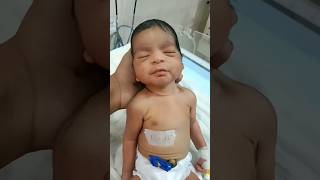 Look at the baby face 😞😞 shorts baby birth cute viralvideo trendingshorts 🥰😍youtubeshorts 💞💞💞 [upl. by Ynamad]