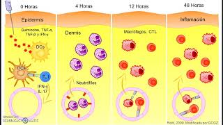 Leishmaniasis visceral  Diagnóstico [upl. by Fancy]