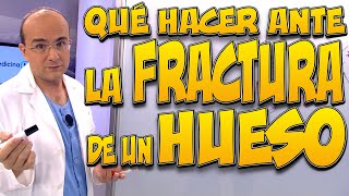 ¿Qué HACER ante la FRACTURA de un HUESO [upl. by Dnaloy993]