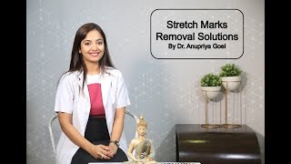 Stretch Marks Removal Solutions By Dr Anupriya Goel [upl. by Marge]