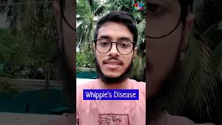 Whipples disease  Malabsorption syndrome  Pathology Medicine Surgery  Dr Med [upl. by Joash]