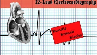 Bundle Branch Blocks  Part 1 [upl. by Acenes]