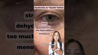 Does your eyelid twitch short shorts healthtips lifehacks healthyliving symptoms eyes [upl. by Urbanna]