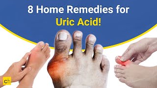 Best 8 Home Remedies for Gout or Uric Acid  Credihealth [upl. by Lama889]