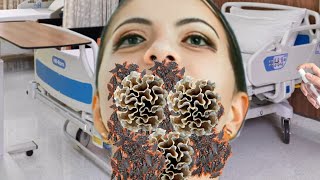 ASMR Remove Maggots amp Dog Ticks neck  Severely Injured Treatment Animation [upl. by Janel171]