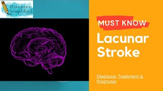 Must Know Lacunar Stroke [upl. by Nadbus784]