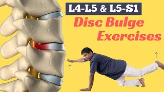 6 Best Diffuse Disc Bulge at L4L5 and L5S1 Treatment Exercises [upl. by Platon]