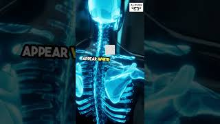 What Is an X Ray Machine  Intro to Biomedical Instrumentation Medical Imaging Device BioMedEng [upl. by Nalor]