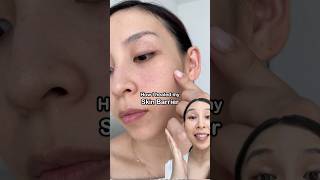 How I repaired my skin barrier in 1 week [upl. by Ynneh]