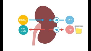 Treating acute salicylate toxicity [upl. by Fanya]