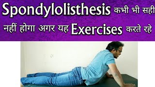 Spondylolisthesis Exercises  Exercises To AVOID For Spondylolisthesis TREATMENT [upl. by Hgalehs969]