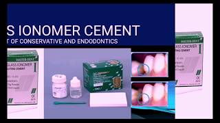 Glass Ionomer Cement GIC [upl. by Ryan]