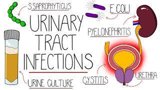 UTI Made Easy  Urinary Tract Infections Explained Clearly [upl. by Esimorp]