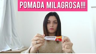 POMADA PARA ALERGIA NA PELE [upl. by Slohcin]