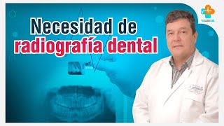 Necesidad de Radiografía Dental  Tu Salud Guía [upl. by Sidran]